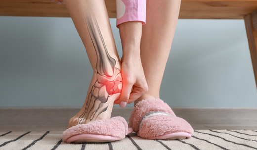 bolečina pete_petni trn_plantarni fasciitis